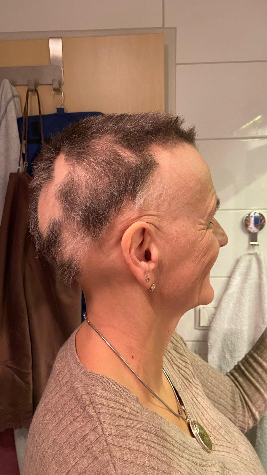 Mangel-Versorgung und Dysbiose