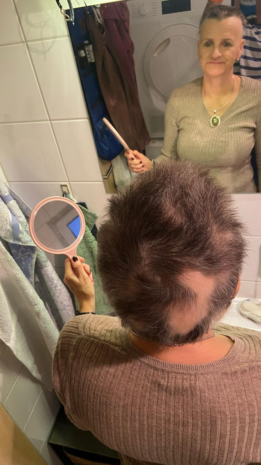 Mangel-Versorgung und Dysbiose